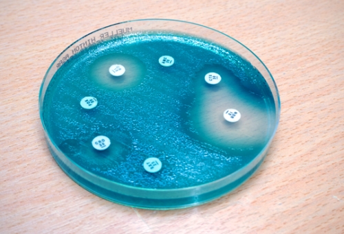 آزمون های آنتی باکتریال Antimicrobial tests