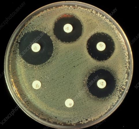 آزمون های آنتی باکتریال Antimicrobial tests
